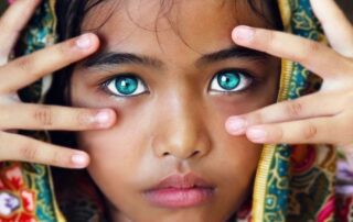 علت داشتن پوست زشت و زیبا چیست