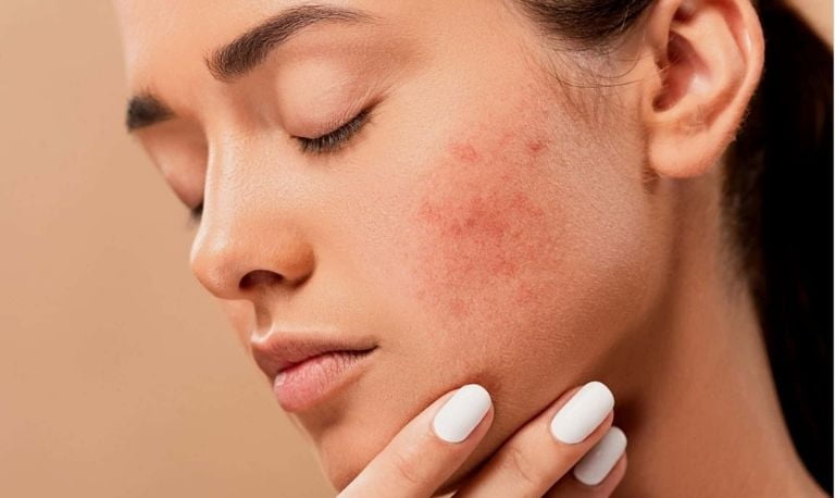 عوامل ایجاد حساسیت پوستی