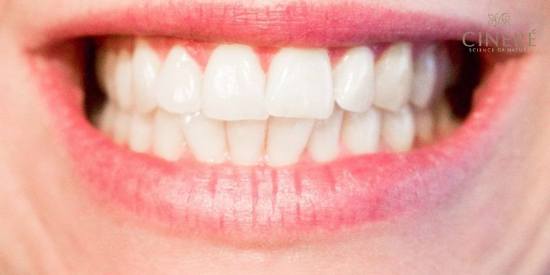پیشگیری از پوسیدگی دندان

