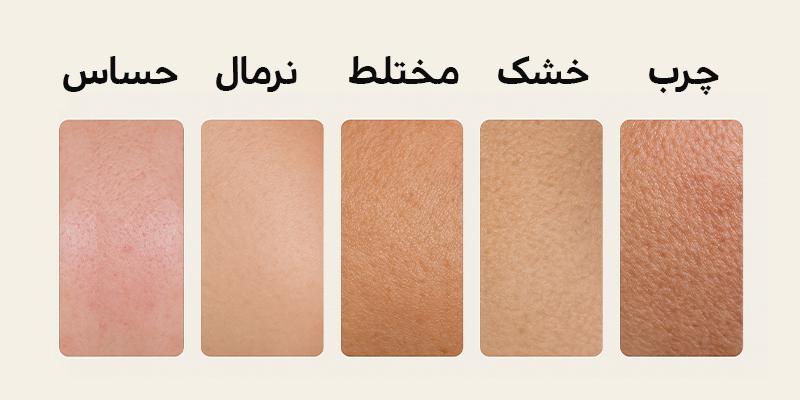 نوع پوست 