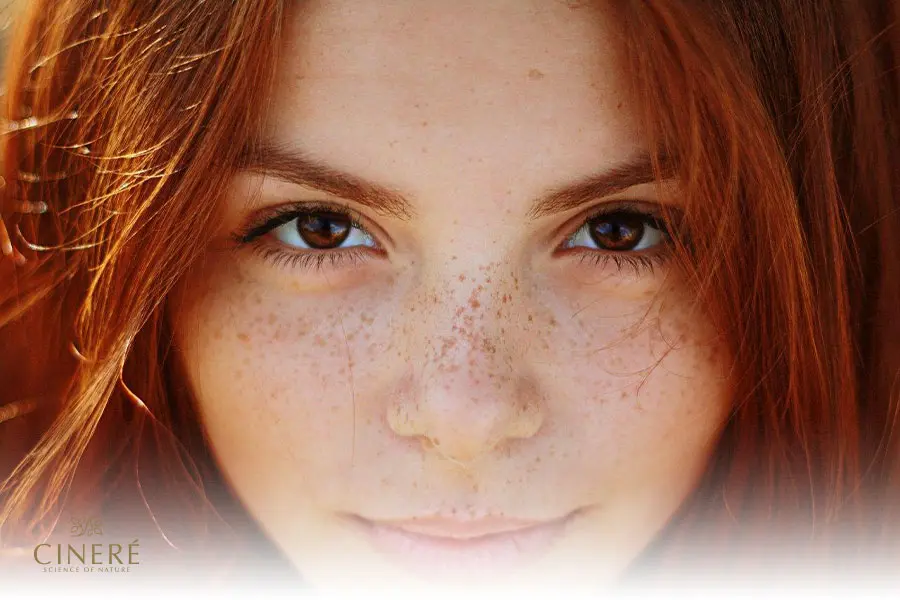 استفاده روشن کنندهها برای درمان لک صورت اهمیت بسیاری دارد.