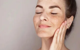 بهترین روتین ضد لک برای انواع پوست صورت