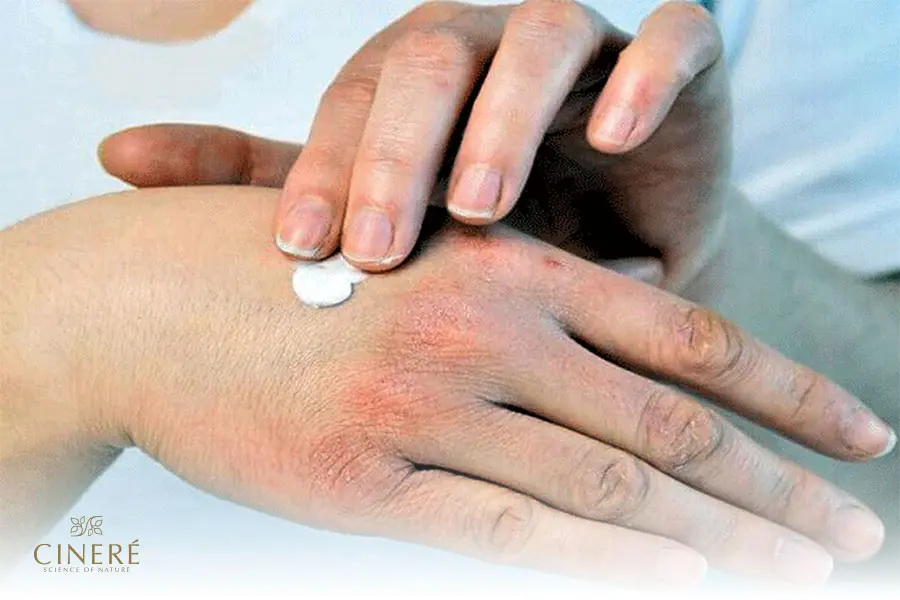 داشتن روتین مراقبتی پوست دست بهترین راه مراقبت از پوست دست است.