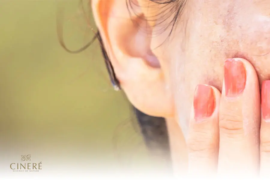 سفید شدن پوست آفتاب سوخته حتی با لکهای قدیمی ممکن است.