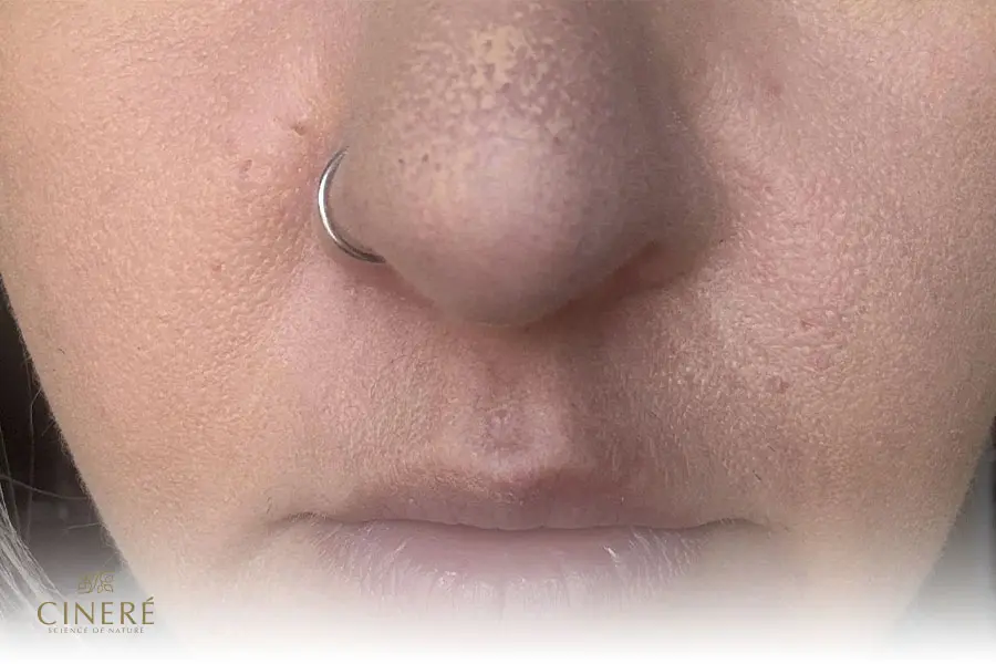 ماسیدن ضدآفتاب روی پوست