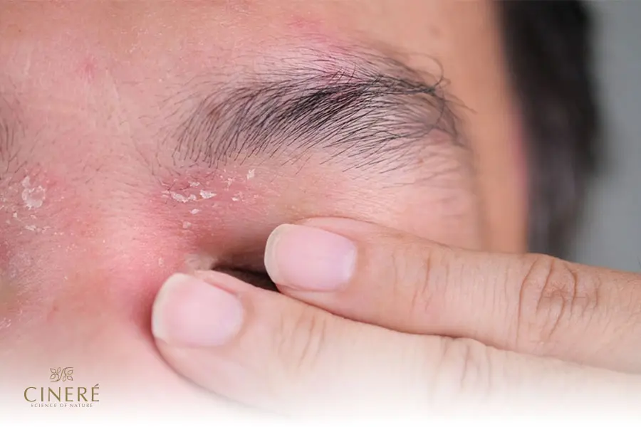 عکس شوره ابرو